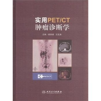 实用PET/CT肿瘤诊断学